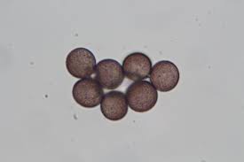 Attēlu rezultāti vaicājumam “Diderma cingulatum spores”