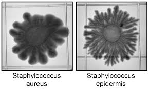 Attēlu rezultāti vaicājumam “Dicranella staphylina cells”