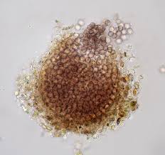 Attēlu rezultāti vaicājumam “Licea minima spores”