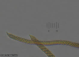 Attēlu rezultāti vaicājumam “Oligonema sp.”