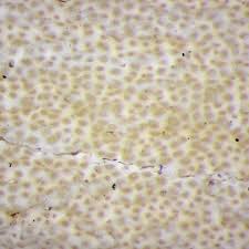 Attēlu rezultāti vaicājumam “Podostroma leucopus”