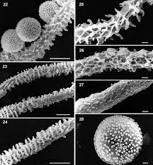 Attēlu rezultāti vaicājumam “Arcyria affinis spores”