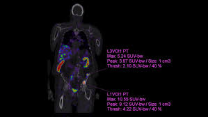 Image result for SIMTA Cumbria