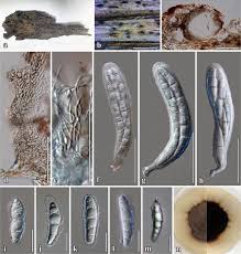 Attēlu rezultāti vaicājumam “Rosellinia desmazieri spores”
