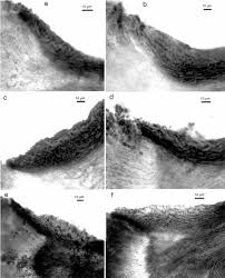Attēlu rezultāti vaicājumam “Chaenotheca trichialis”