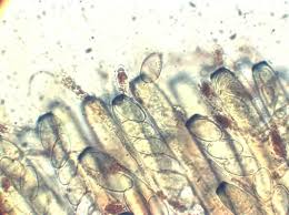 Attēlu rezultāti vaicājumam “Peziza flavida”