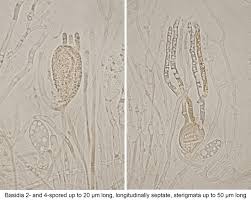 Attēlu rezultāti vaicājumam “Exidia thuretiana”