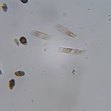 Attēlu rezultāti vaicājumam “Calicium salicinum”