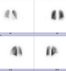 Image result for  v    q