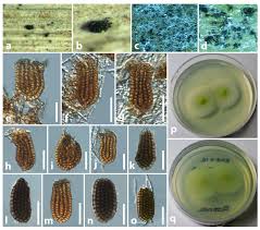 Attēlu rezultāti vaicājumam “Diachea dictyospora (syn. Craterium dictyosporum) spores”