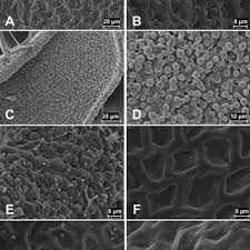 Attēlu rezultāti vaicājumam “Odontoschisma denudatum cells”