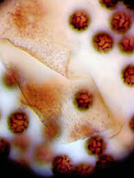 Attēlu rezultāti vaicājumam “Diachea muscorum”