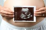 Question - Accuracy of dating scans | babyworld