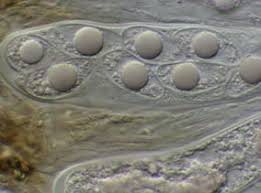 Attēlu rezultāti vaicājumam “Trapelia coarctata”