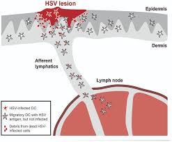 Attēlu rezultāti vaicājumam “Diderma simplex”