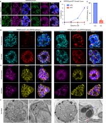 Attēlu rezultāti vaicājumam “Symphytocarpus impexus plasmodium”