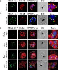 Attēlu rezultāti vaicājumam “Oligonema favogineum plasmodium”