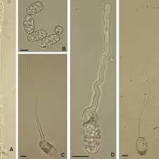 Attēlu rezultāti vaicājumam “Sawadaea tulasnei”