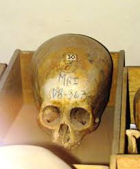 Image result for elongated skulls