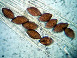 Attēlu rezultāti vaicājumam “Melanospora lagenaria”