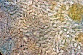 Attēlu rezultāti vaicājumam “Hyphodiscus hymeniophilus”