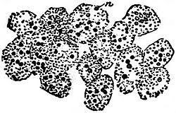 Attēlu rezultāti vaicājumam “Badhamia utricularis plasmodium”