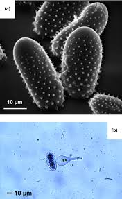 Attēlu rezultāti vaicājumam “Melampsora magnusiana”