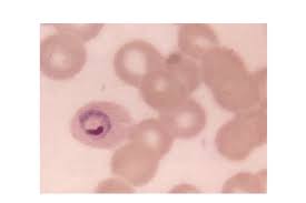 Attēlu rezultāti vaicājumam “Reticularia lobata plasmodium”