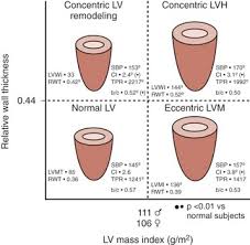 Image result for  ^ L V [ h    