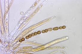 Attēlu rezultāti vaicājumam “Hypocrea gelatinosa”