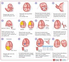 Image result for HTRPC