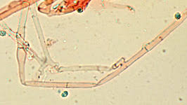Attēlu rezultāti vaicājumam “Trechispora mollusca”