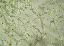 Attēlu rezultāti vaicājumam “Nostoc commune macro”