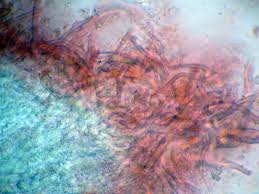 Attēlu rezultāti vaicājumam “Elmerina caryae”