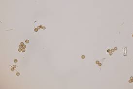 Attēlu rezultāti vaicājumam “Reticularia lycoperdon spores”