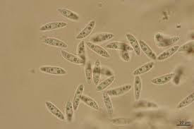 Attēlu rezultāti vaicājumam “Hymenoscyphus calyculus”