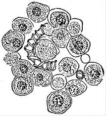 Attēlu rezultāti vaicājumam “Amaurochaete atra spores”