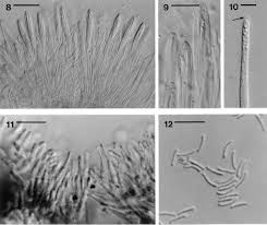 Attēlu rezultāti vaicājumam “Rhytisma acerinum”