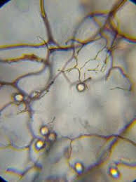 Attēlu rezultāti vaicājumam “Stemonitopsis hyperopta”