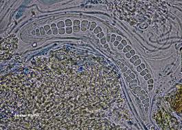 Attēlu rezultāti vaicājumam “Thelotrema lepadinum”