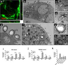 Attēlu rezultāti vaicājumam “Enteridium variabile spores”