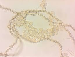 Attēlu rezultāti vaicājumam “Ophiotheca chrysosperma spores”