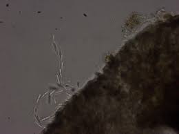 Attēlu rezultāti vaicājumam “Melanospora lagenaria”