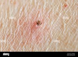 Attēlu rezultāti vaicājumam “Ixodes female”