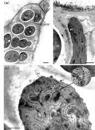 Attēlu rezultāti vaicājumam “Nostoc commune cells”