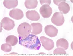Attēlu rezultāti vaicājumam “Siphoptychium violaceum plasmodium”