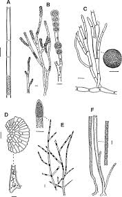Attēlu rezultāti vaicājumam “Trentepohlia sp.”