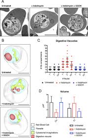 Attēlu rezultāti vaicājumam “Dianema depressum plasmodium”