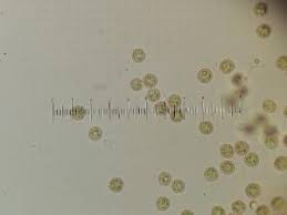 Attēlu rezultāti vaicājumam “Cribraria lepida”