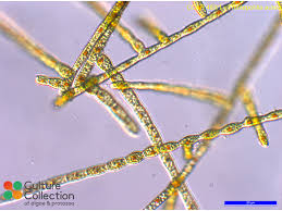 Attēlu rezultāti vaicājumam “Trentepohlia sp.”